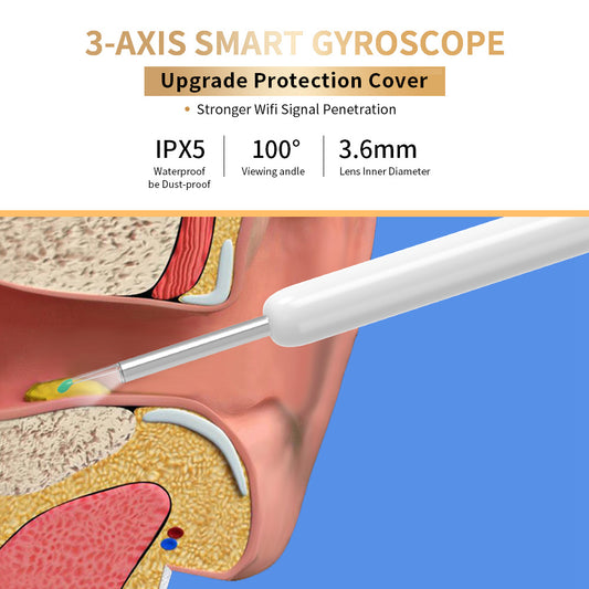 NE3 Wireless Ear Wax Removal Tool with Camera – LED Otoscope Ear Cleaner Kit for iPhone & Android
