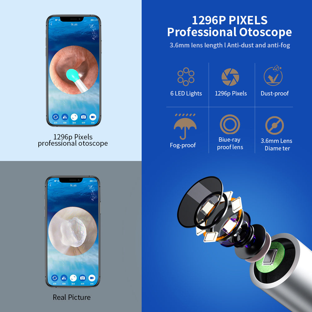 NE3 Wireless Ear Wax Removal Tool with Camera – LED Otoscope Ear Cleaner Kit for iPhone & Android